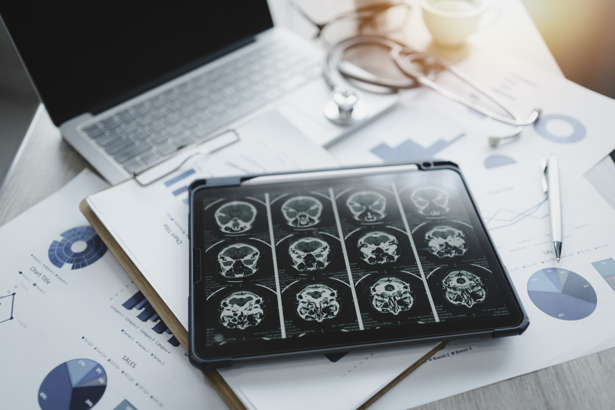 Alzheimer’s & Brain Awareness Month highlights the importance of brain health in North Carolina